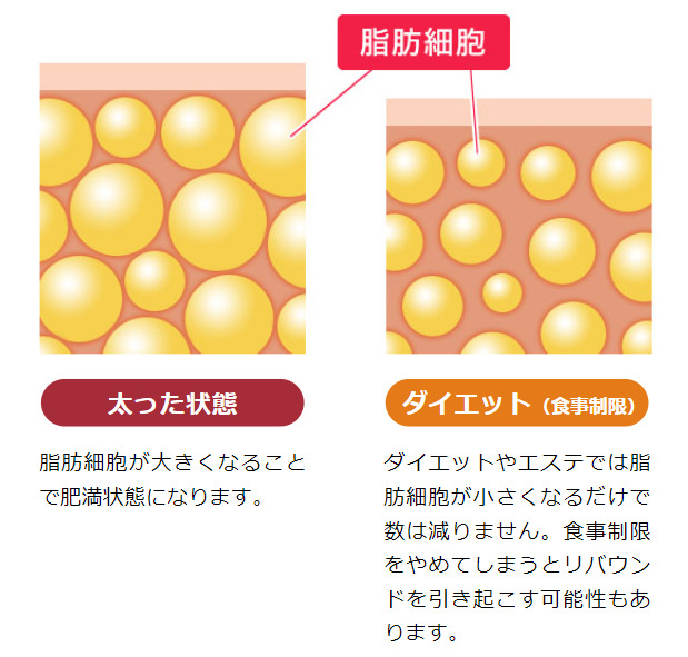 エバースリムによる脂肪細胞の減少効果