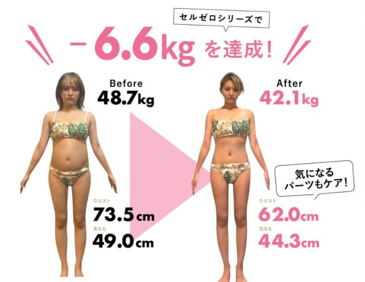 ダイエット脱毛エステサロンセルライト除去スリムビューティーハウスのボディクリーム