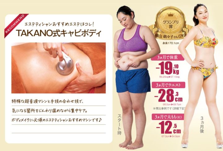 キャビテーション月10回はやりすぎ？やりすぎた場合の効果や副作用を  