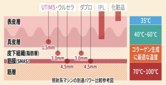 メンズエミナル　ハイフ