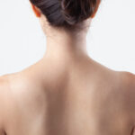 福岡で肩ボトックスが安いおすすめクリニック8選|天神・博多から北九州・小倉まで紹介