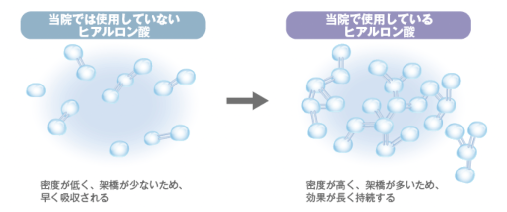 高須クリニック　ヒアルロン酸