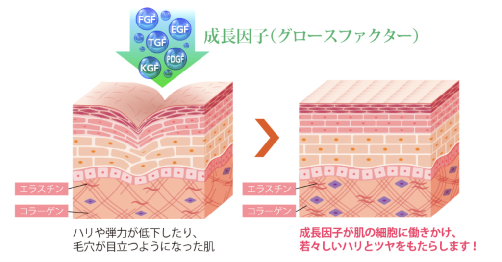 ほうれい線治療　おすすめ