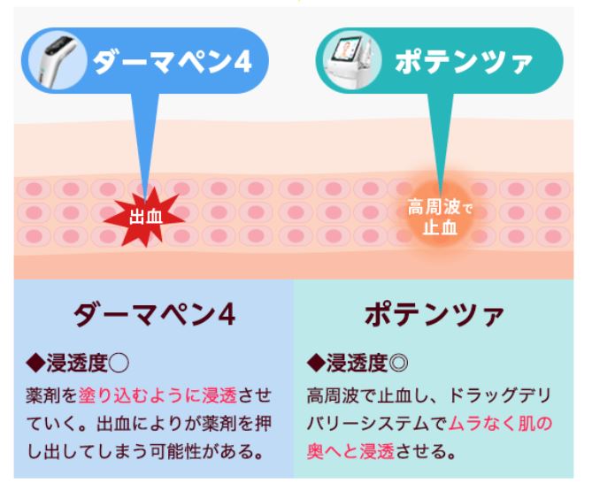 ポテンツァ[ドラッグデリバリー システム]の仕組み解説画像