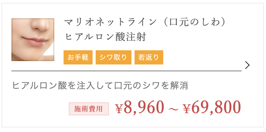 TCB東京中央美容外科 ヒアルロン酸