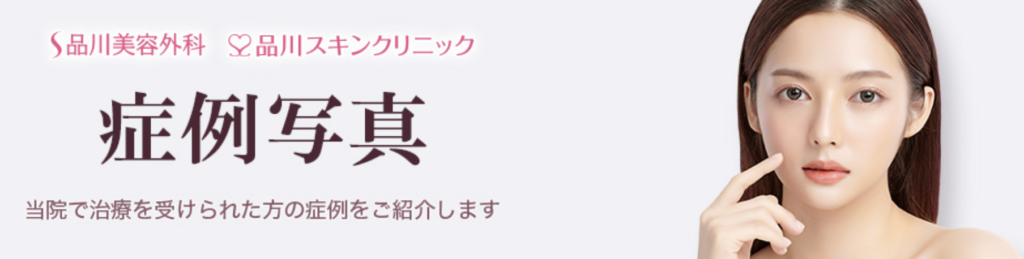 品川スキンクリニック　千葉　肩ボトックス