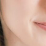 札幌市で糸リフトが安いおすすめのクリニック16選！リフトアップ術が上手い名医みつかる！