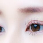 名古屋で眉上(眉丘筋)ボトックスが安いおすすめのクリニック3選