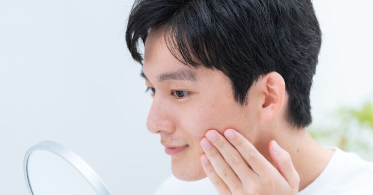 【メンズ向け】男性のシミ取りレーザーが安いおすすめのクリニック8選｜料金相場やシミ取り経験者の口コミも紹介