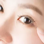 【名医紹介】千葉でクマ取り・目の下のたるみ取りが安いおすすめのクリニック6選