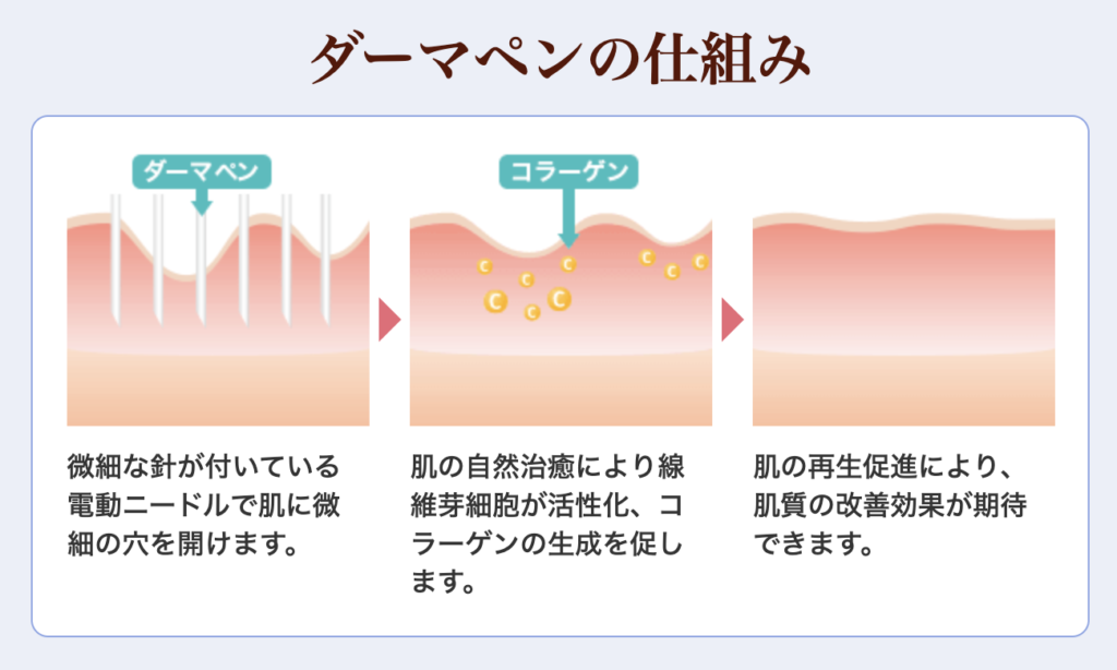 ダーマペンの仕組み　品川美容外科