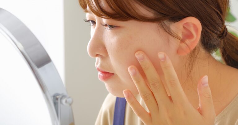 横浜でそばかすレーザー治療が安いおすすめの美容皮膚科クリニック9選