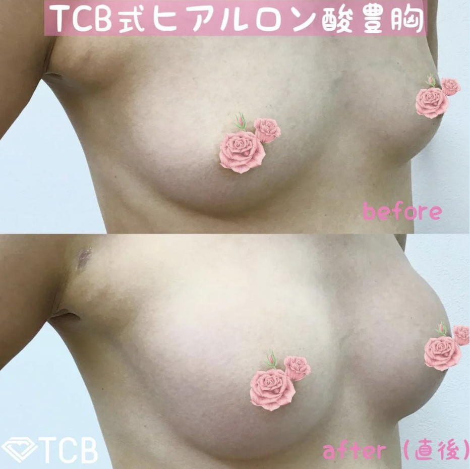 tcb 梅田