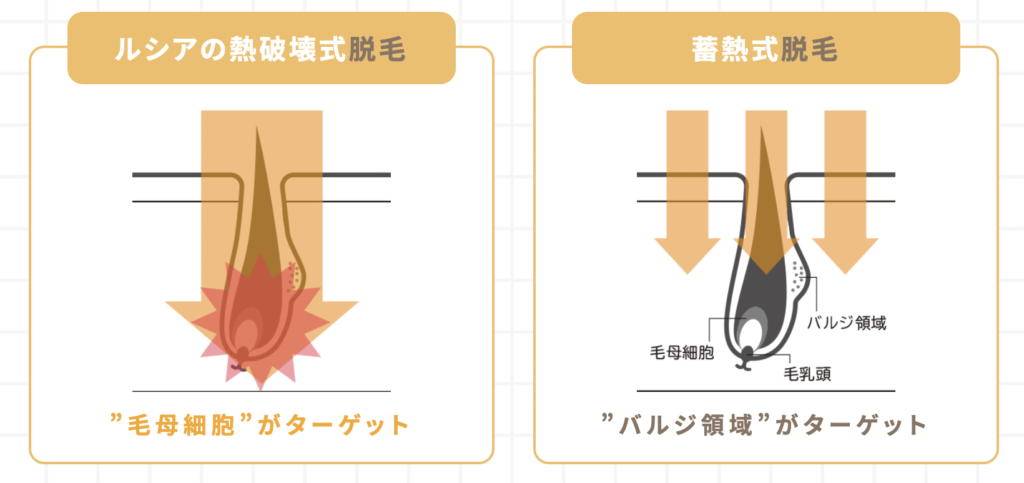 ルシアクリニック　名古屋　VIO脱毛