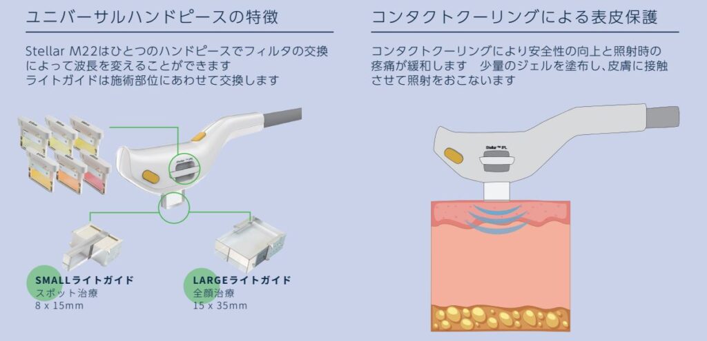 ステラM22製品概要