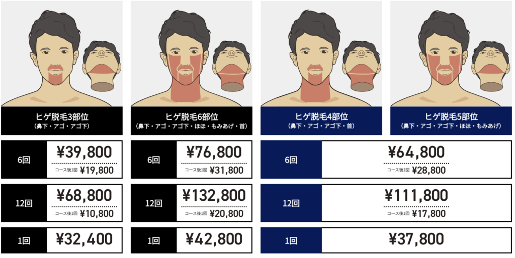 ゴリラ　メンズエミナル　どっち