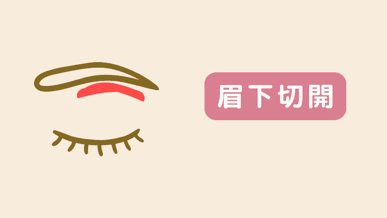 眉下切開