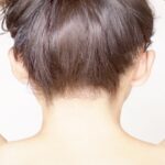 札幌でうなじ脱毛が安い人気の医療脱毛クリニック6選