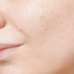 【1万円台！？】東京でサブシジョンが安いおすすめのクリニック9選｜安さ・痛み・効果を比較