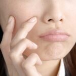 福岡でサブシジョンが安いおすすめのクリニック7選｜北九州の病院も紹介
