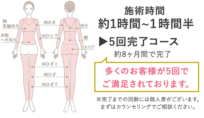 ウィルビークリニック　全身脱毛