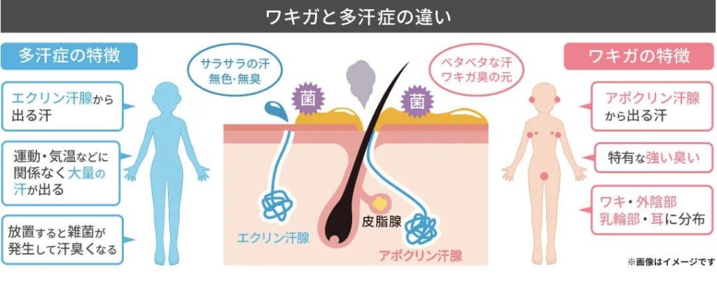 多汗症とワキガの違い