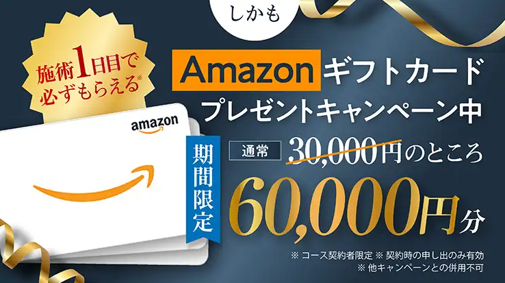 アマゾン　DIO特典4