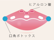 ルラ美容クリニック　Cカールリップ