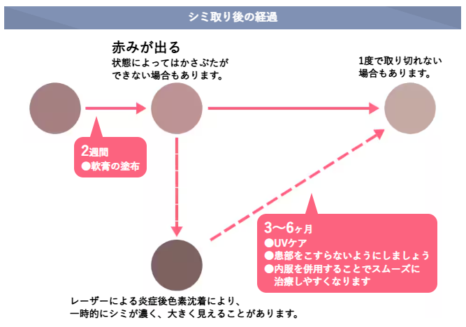湘南美容クリニック　シミ取り