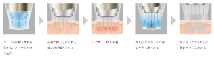 ルラ美容クリニック　ポテンツァ