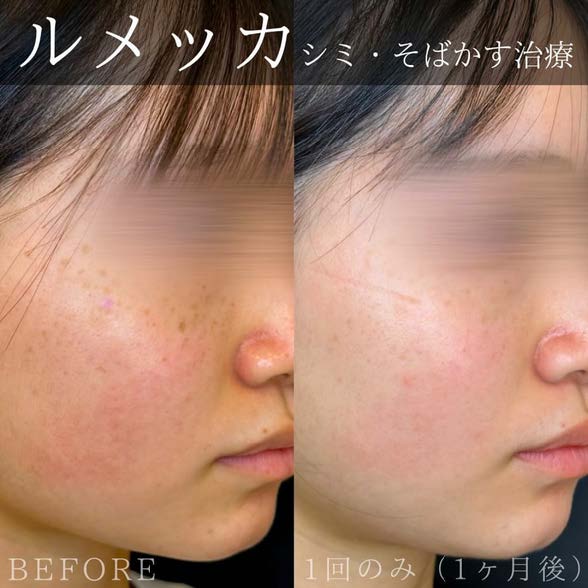 ルラ美容クリニック症例