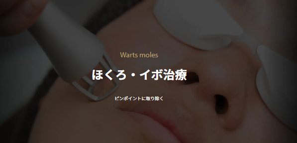 ゴリラクリニック ほくろ除去