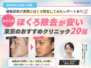 【経験者が選ぶ】東京でほくろ除去の取り放題が安いおすすめ美容クリニック20選｜跡が残らない評判のいい病院を厳選
