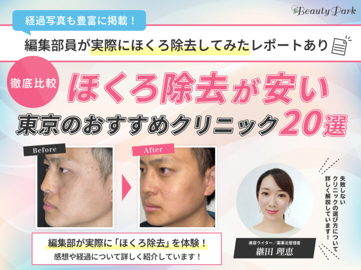 【経験者が選ぶ】東京でほくろ除去の取り放題が安いおすすめ美容クリニック20選｜跡が残らない評判のいい病院を厳選