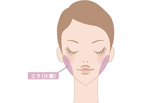 エラボトックス　品川美容外科