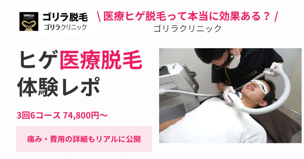 【ゴリラクリニック福岡天神院レビュー】医療ヒゲ脱毛を体験レポート!痛みや院内の様子も紹介