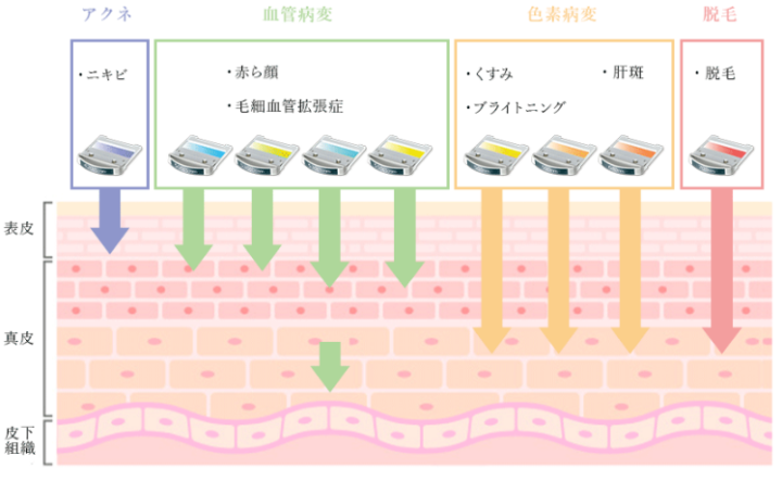 聖心美容クリニック　セレックV　