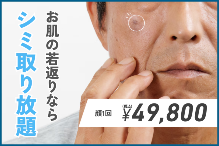 湘南メンズシミ取り放題