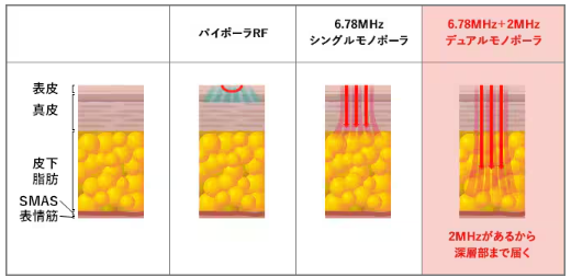 湘南美容クリニック　XERF（ザーフ）