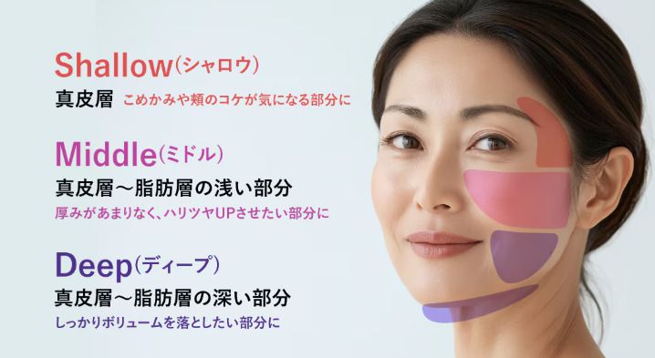 湘南美容クリニック　XERF（ザーフ）