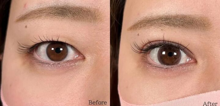 森宮 佳輝医師 二重症例