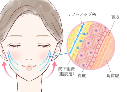 ルラ美容クリニック　ルナリフト