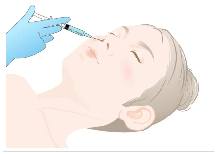 TCB東京中央美容外科　花粉症ボトックス