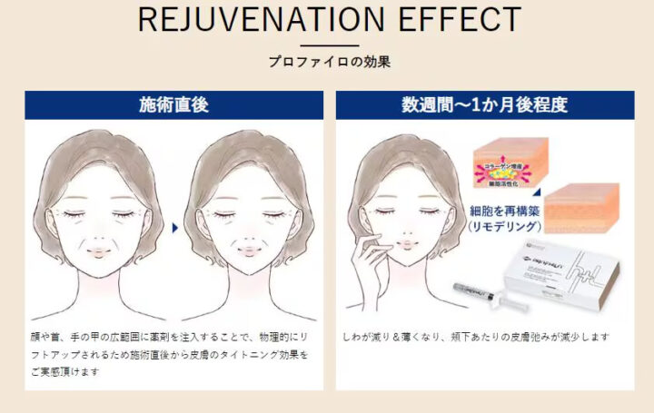 プロファイロ 湘南