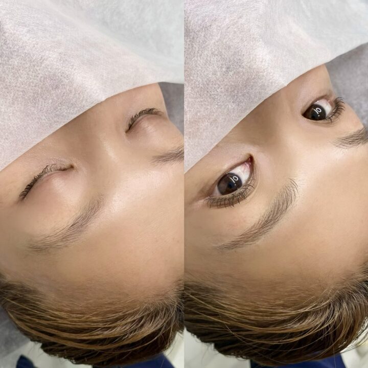 Gメディカルアートクリニック　眉アート症例画像