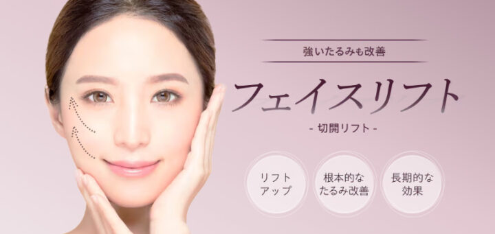 湘南美容クリニック　フェイスリフト