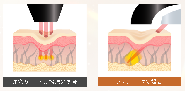 ルラ美容クリニック　ブレッシング