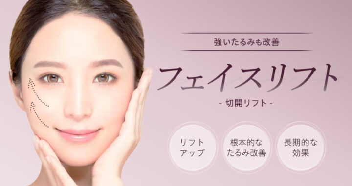 湘南　フェイスリフト