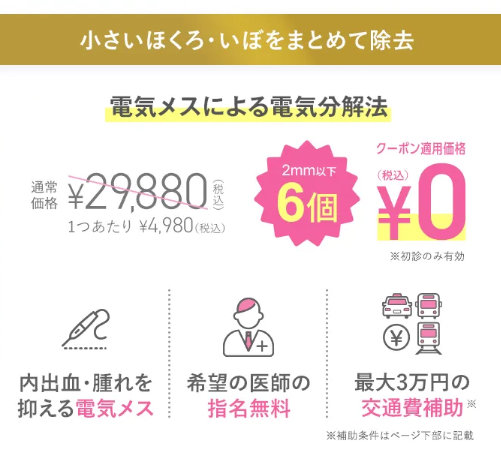 TCB　いぼ除去クーポン