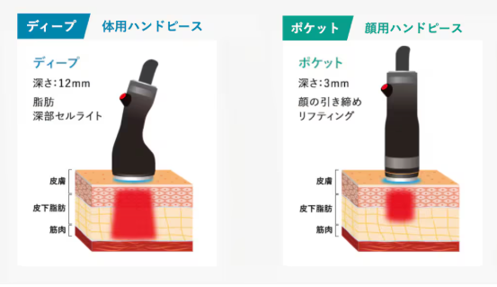 湘南美容クリニック　オンダリフト